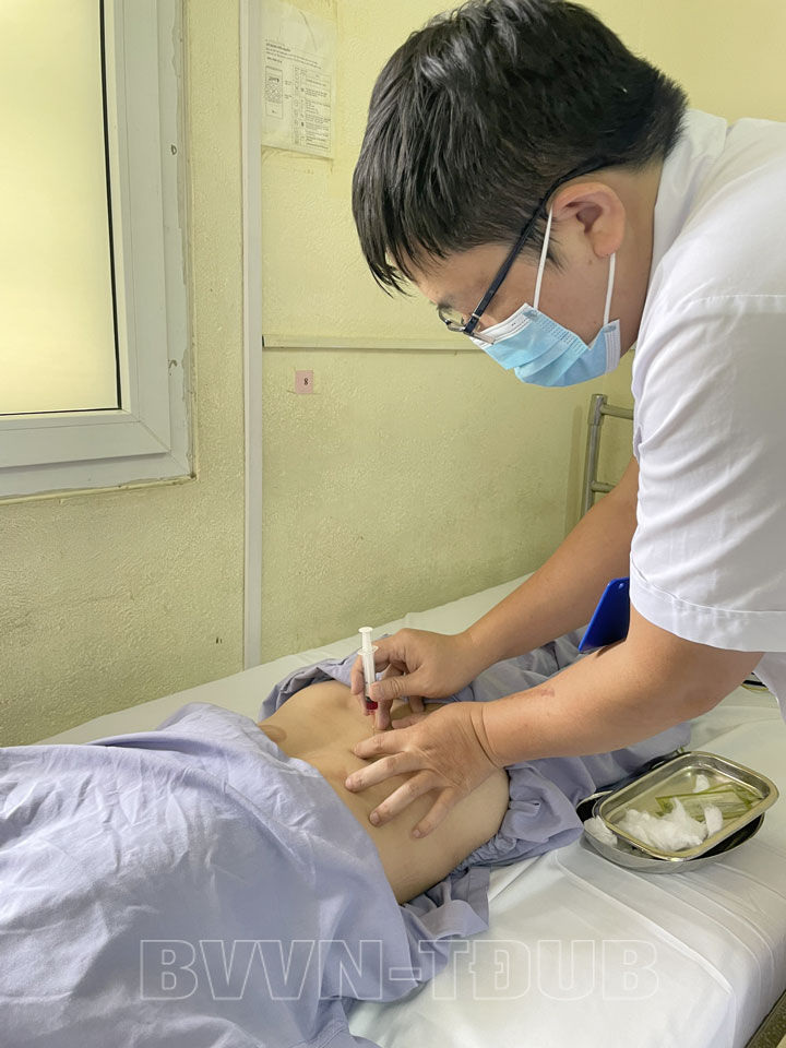 Thủy châm