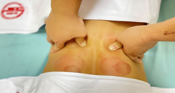 Xoa bóp thoát vị đĩa đệm cột sống thắt lưng